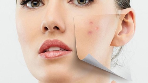 Problémás a bőröd? Tegyél ellene tudatosan!