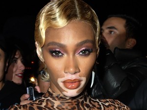 Winnie Harlow totál pucér volt a Met gála afterpartiján