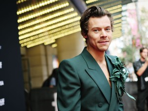 Kapaszkodj meg: Harry Styles teljesen kopasz lett