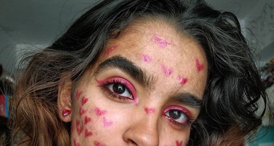 Pattanások az arc különböző részein: ilyen betegségekre utalhatnak