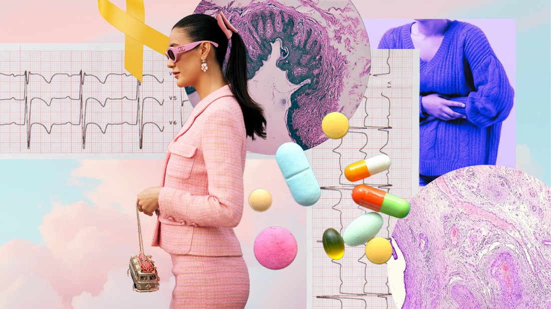 Az endometriózis nemcsak jelentős fizikai, hanem érzelmi kihívásokat okoz a betegnek