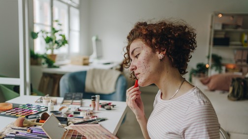 Ezt jelenti, ha mindig ugyanott jelennek meg a pattanásaid