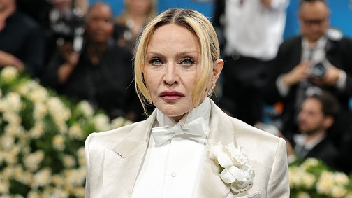 Mi történt Madonna mosolyával? A rajongók szerint az egyik legjellegzetesebb vonását változtatta meg