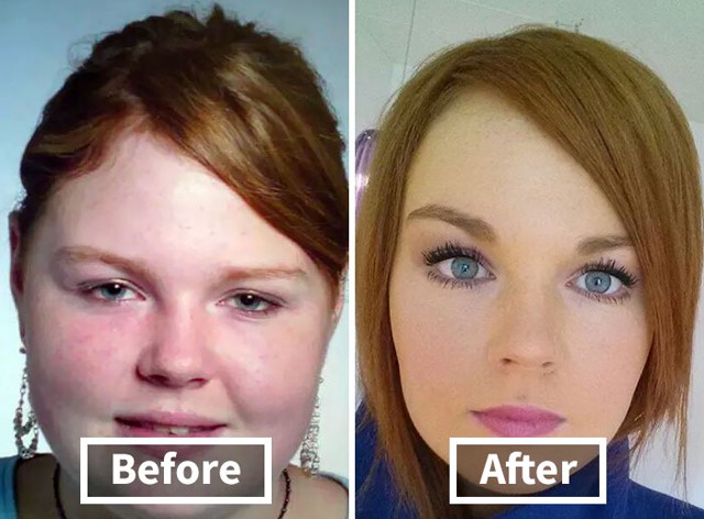 Így változik az ember arca a fogyástól! *Megdöbbentő előtte-utána fotók!*