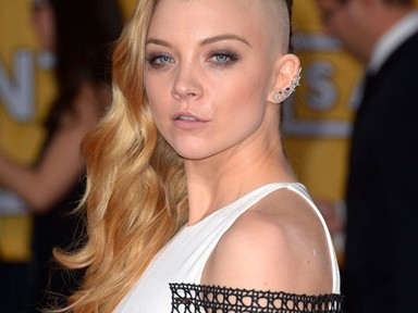 Brutális frizurával sokkolt a Trónok harca bájos színésznője