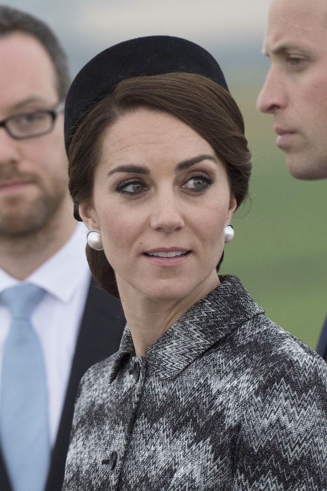 kate middleton, katalin hercegné, plasztika, botox, cambridge