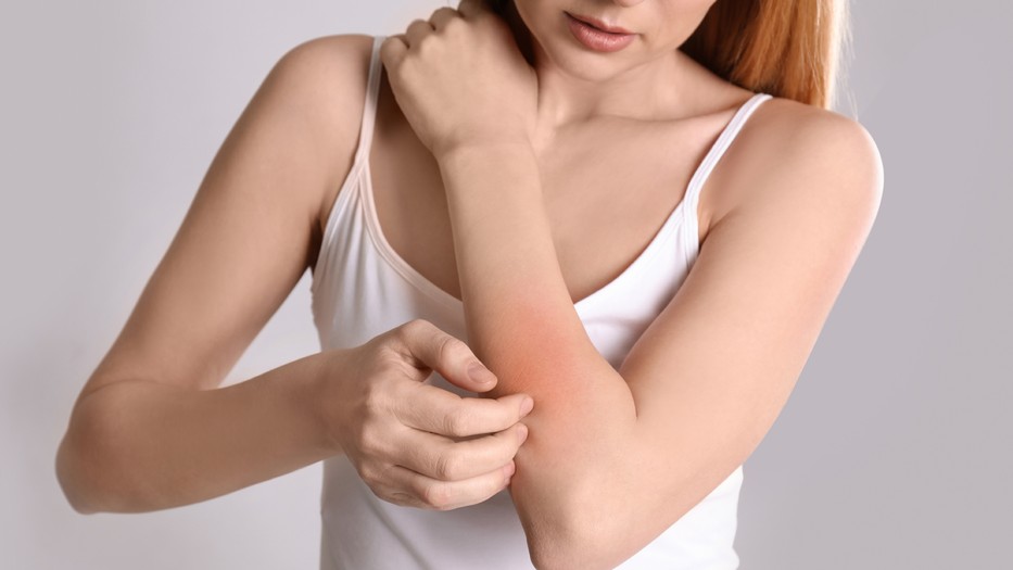 AdobeStock 270441931 piel atopica 2