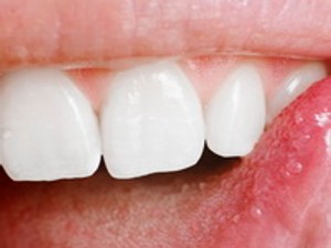 Rossz fogak számos betegség hátterében