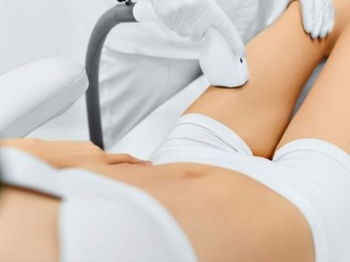 Lézeres szőrtelenítés: kiknél lehet a leghatásosabb a végeredmény?