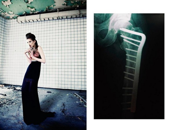 Fotó: Csoboth Edina, Modell: Barabás Henriett/Attractive, Styling: Frák Péter, Smink: Kunkuma Drucker, Fodrász: Vörös Anett /Microphone Hair, Fotóasszisztens: JámborZsófi, Tipo: Liziczai RékaRuhák : Napsugar von Bittera, Nora Sarman, Vivienne Westwood, ASOS, Mellow Yellow, Aldo, Zara & Vintage Pieces