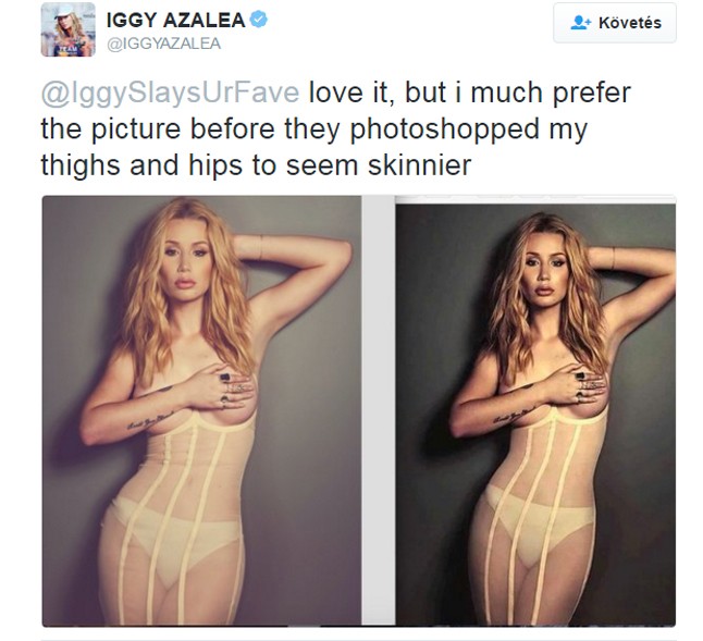 Iggy Azalea csípőjét is jól lefaragták, a rapper fel is háborodott