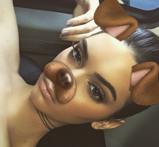 Ijesztő trend: plasztikai beavatkozás, hogy jobban hasonlíts a Snapchat képekre