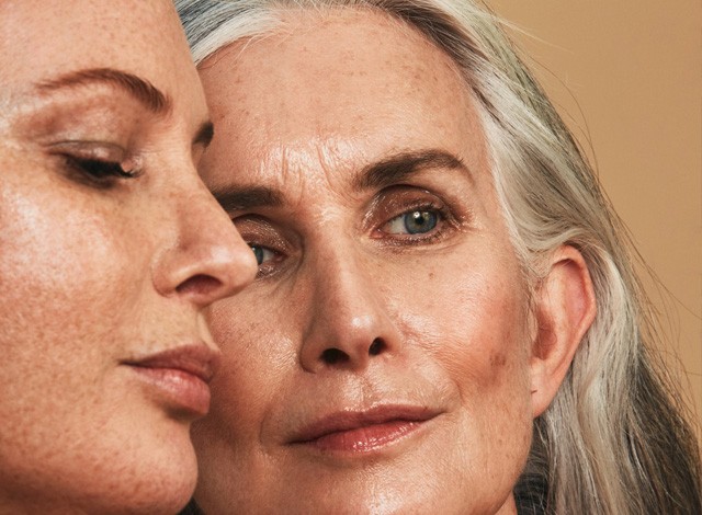 Újabb kampány adja tudtunkra, hogy narancsbőrrel, szeplőkkel, ráncokkal együtt vagyunk gyönyörűek