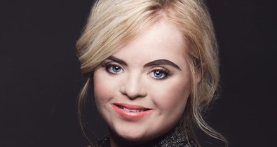 Óriási sikert ért el a gyönyörű Down-szindrómás modell