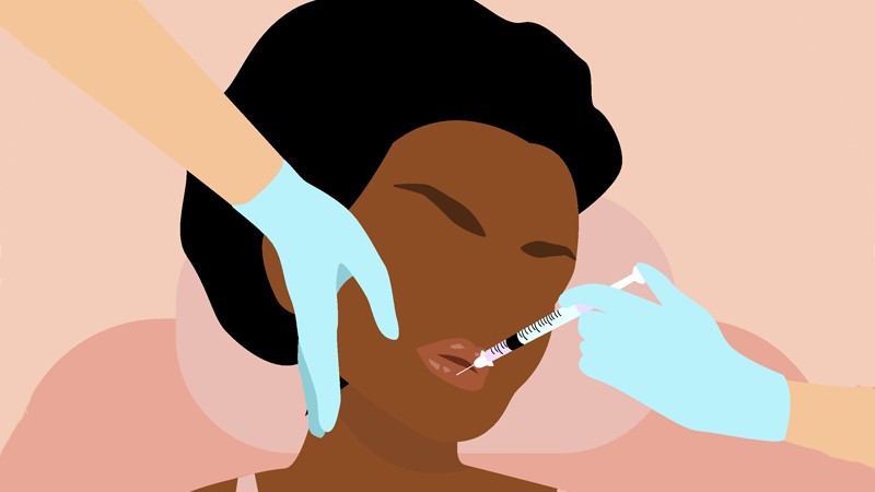 10+1 kérdés, amit tegyél fel a bőrgyógyásznak, mielőtt belevágnál az arc- és szájfeltöltésbe