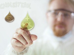 Mi az LDL - HDL? Miért fontos az egyensúlya?