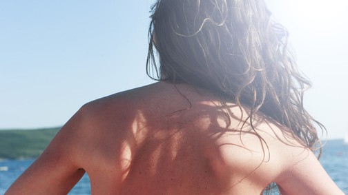 Ezért ne kotyvassz otthon SOHA napvédő krémet