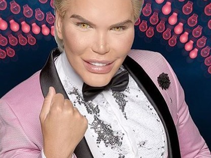 Őrület: Így nézett ki az élő Ken baba a műtétek előtt