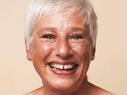 Gyönyörű fotók masztektómián átesett nőkről, akik megmutatják sebeiket és erőt adnak a rák elleni küzdelemben