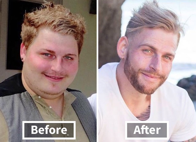 Így változik az ember arca a fogyástól! *Megdöbbentő előtte-utána fotók!*