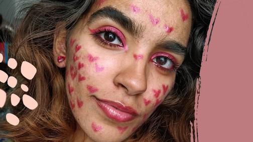 A bőröm története: így szabadultam meg a pattanásoktól és a hegektől