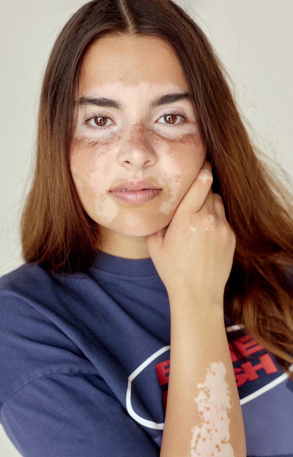 A pszichológus szerint segíthet, ha szembe merünk nézni a problémával