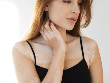 Amikor a tükör végre visszamosolyog: ingyenes sminktetoválás hegekre és bőrelváltozásokra