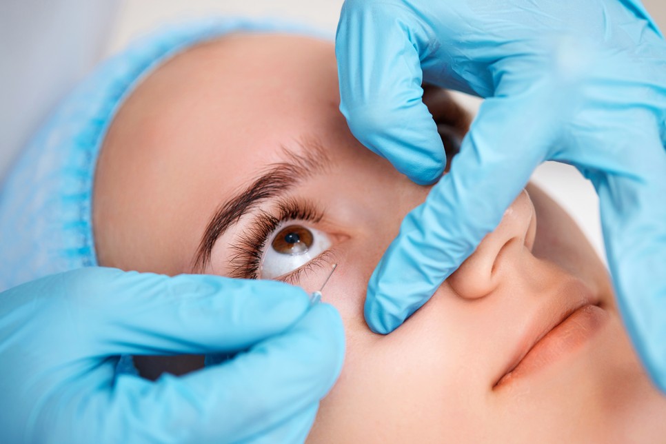 Érdemes bőrgyógyászhoz fordulni, ha úgy érzed, egyedül már nem tudod kezelni az aknéidat!