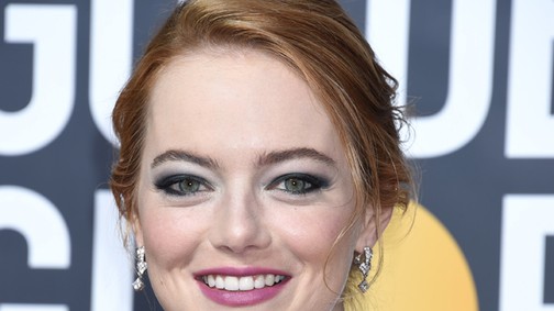 Emma Stone elég nagyot változtatott a frizuráján, de jól tette?