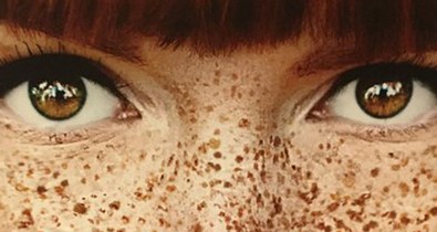 Szeplős vagy? Talán lesz, aki szeretni fog így is.