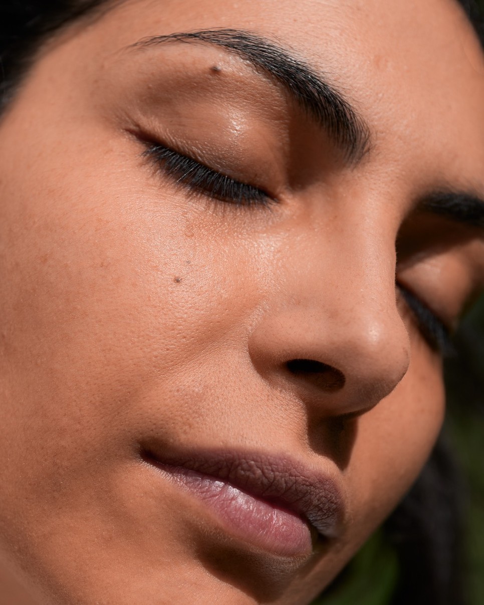 Farkas Franciskának ma már nem okoz nehézséget elfogadni az anyajegyeit