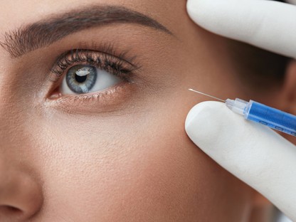 Hialuronsavas feltöltéssel a sötét karikák ellen – Egy módszer, amivel végre látványos eredményt érhetsz el!