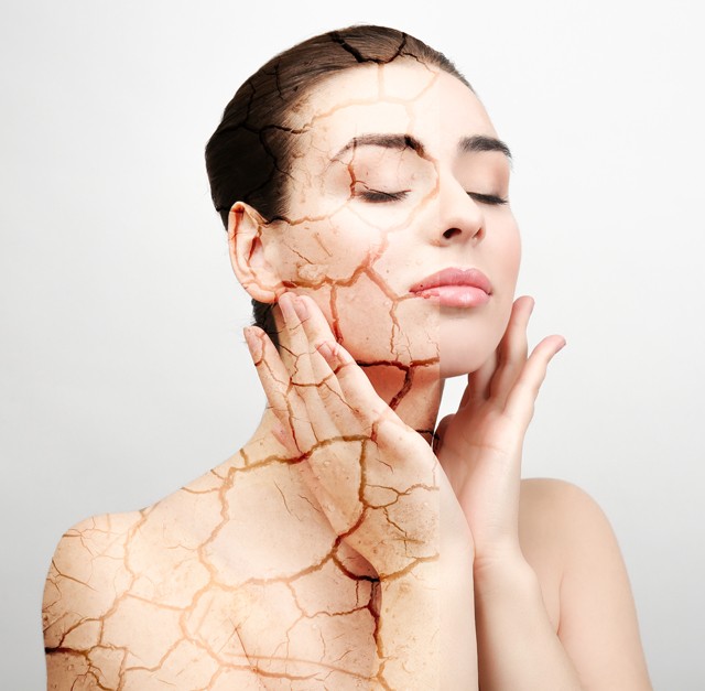 Jelek, hogy a stressz az elméden kívül a bőrödre is kihat