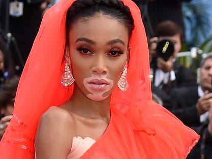 Winnie Harlow akkorát villantott, hogy oda sem merünk nézni, de még így is látjuk...