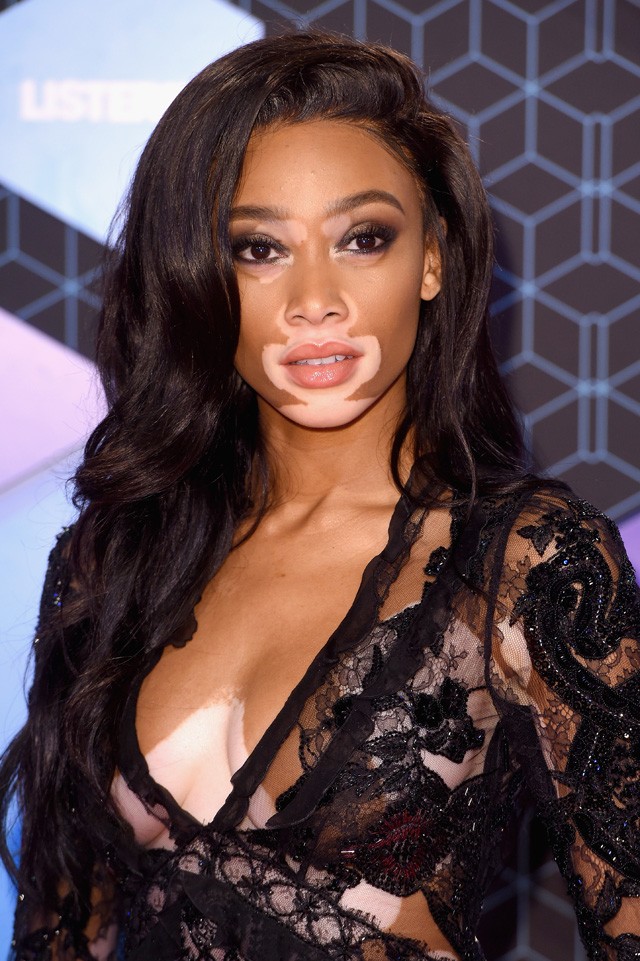 Winnie Harlow egy szál tangában osztja meg életbölcsességeit