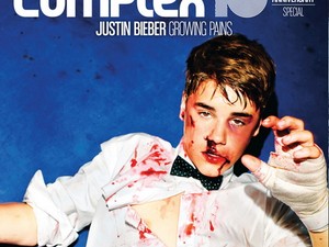 Vérző fejjel került a padlóra Justin Bieber