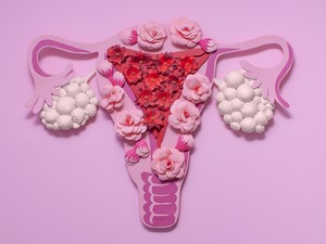 A két leggyakoribb női krónikus betegség, az IBS és a PCOS között szorosabb az összefüggés, mint eddig gondolták