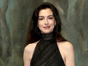 Mégis mi történt Anne Hathaway arcával? Ledöbbentek a rajongók a színésznő Oscar-gálás megjelenésén