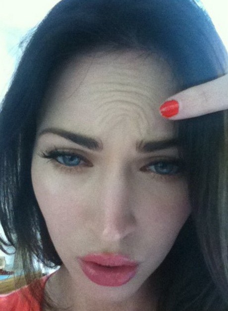 460-megan-fox-botox-d0000DB4C346435f9d87f.jpg