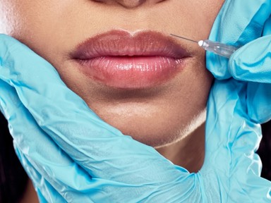 Terjednek az illegális töltőanyagok az esztétikai kezelésekben, az összetevők gyulladást, fertőzést vagy akár szövetelhalást is okozhatnak