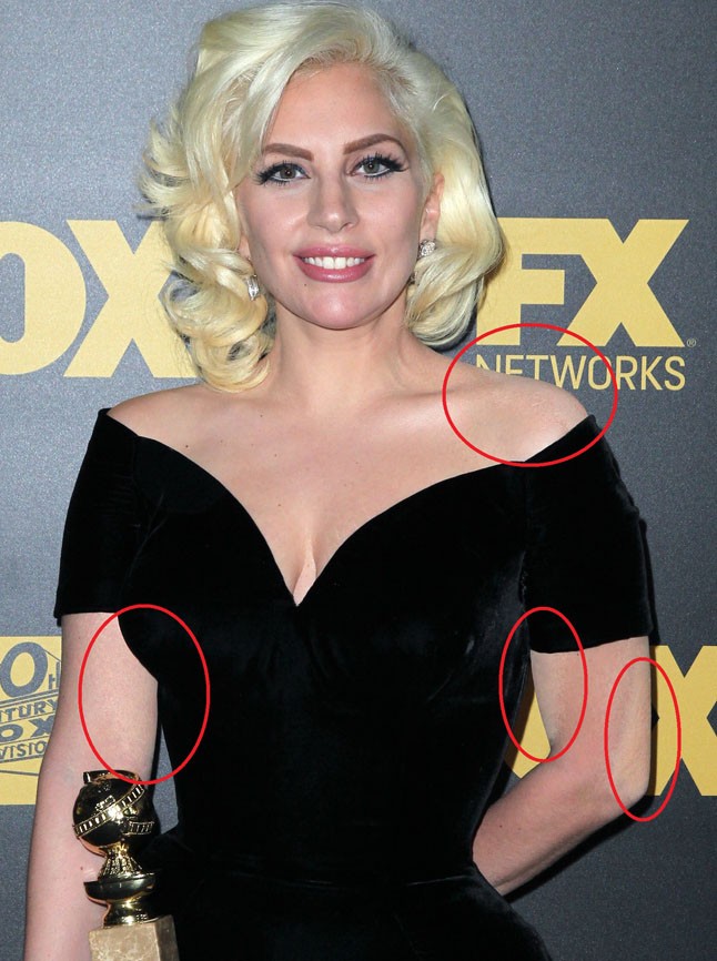 Te is látod, hogy lealapozózták Lady Gaga tetkóit, ugye?