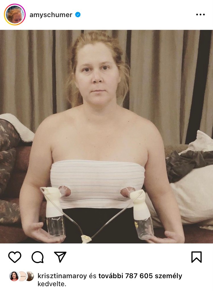 Amy Schumer