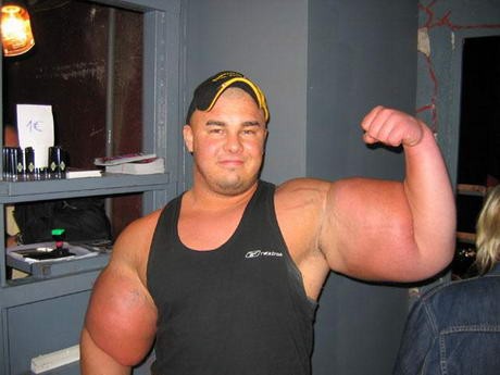 synthol-nagyjpg-d000072C1b2108361be26.jpg