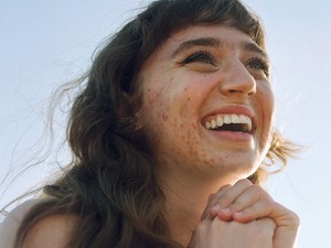 Harcban a bőröddel: 3 nő, különböző bőrproblémákkal - mit mond a szakértő?