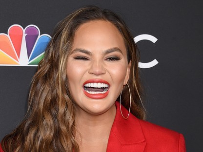 De mi a bánatért botoxoltatta Chrissy Teigen a hónalját?
