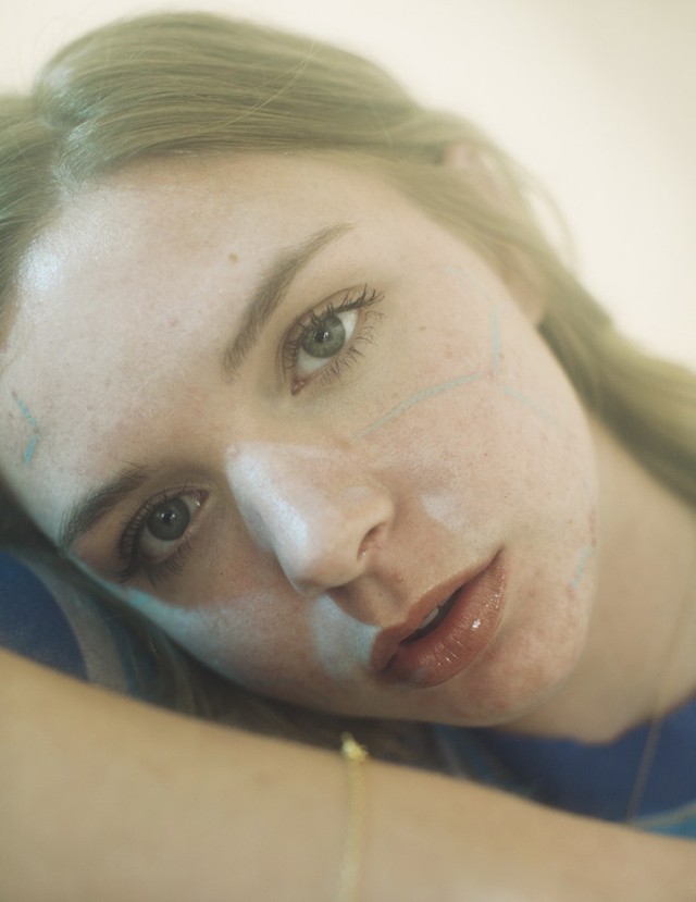 Ez a két művész nem eltünteti, hanem kiemeli a pattanásokat