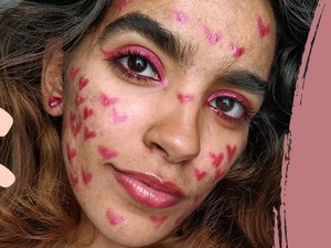 A bőröm története: így szabadultam meg a pattanásoktól és a hegektől