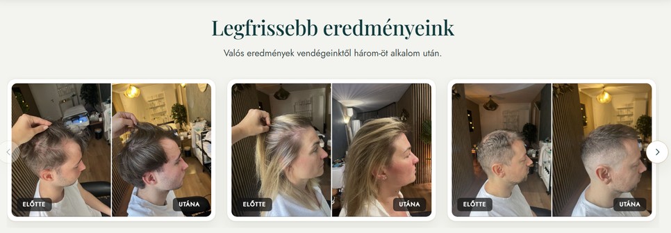Több hónapos kezelés után megfigyelhet a látványos változás
