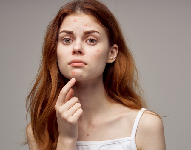 13 dolog, amiről nem gondolnád, mégis sokat árt az arcbőrödnek