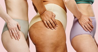 Ezt jelzik a fenekeden megjelenő pattanások: mutatjuk, hogyan szabadulj meg tőlük